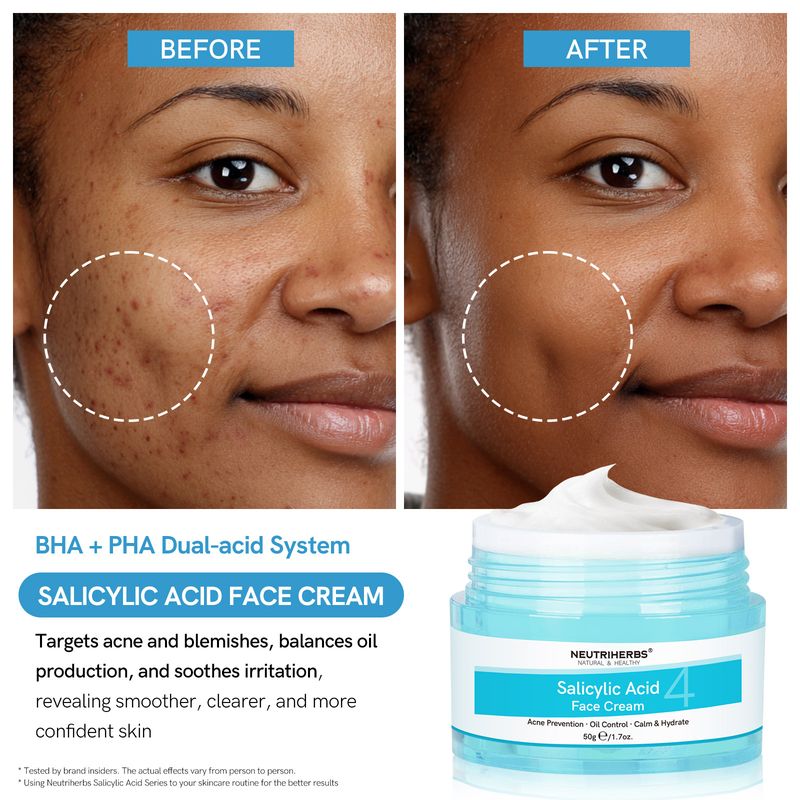 Neutriherbs Salicylic Acid Face Cream — view 5